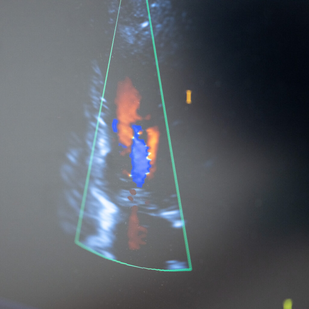 Ultraschalluntersuchung in der internistischen Praxis in Innsbruck